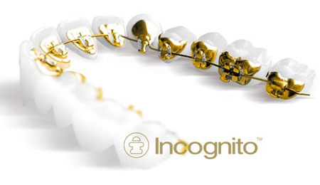 Aparaty Incognito