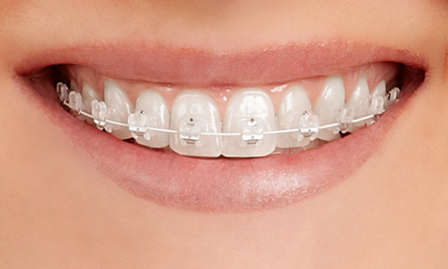 Teeth Empower Clear